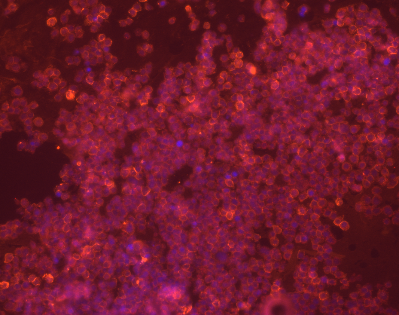 Lovo drug 20x Bottom Slide M p01 0 A01f00d0